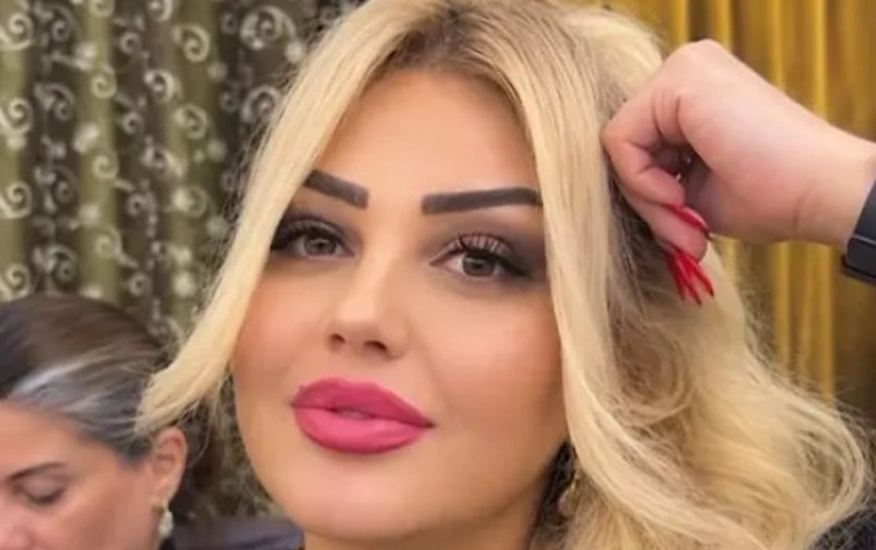 Bakıda qadın dişini çəkdirdiyinə görə vəfat edib?